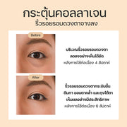 RF Eye Massager ( เครื่องนวดรอบดวงตา )